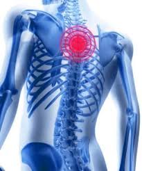 Mid Back Pain Chiropractic Ballina And Byron Bay Discover Chiropractic Centre