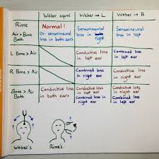 questions regarding tuning fork tests my ent performed today