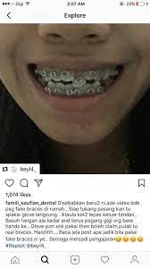 Kisah kehidupan keluarga kerajaan ini jadi tragedi. Jangan Terpedaya Dengan Pendakap Gigi Yang Dijual Pada Harga Yang Lebih Murah