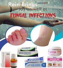 Homeopathy medicine for skin disease. Homeopathy Medicine List For Fungal Infections Buy Online Get Upto 15 Off Homeopathy Medicine Homeopathy Plaque Psoriasis Treatment