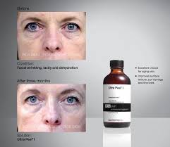 Desert Lotus Aesthetics: Skin Care by Suzette