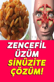 Zencefil Uzum Sinuzite Cozum In 2020 Health Food Vegetables