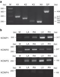 Download la bloc episodul 37. Genome Wide Screening Identifies A Kcnip1 Copy Number Variant As A Genetic Predictor For Atrial Fibrillation Nature Communications