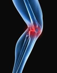 Cppd What You Need To Know Rheumatoid Arthritis Diet Arthritis Knee Arthritis