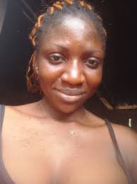 Any cream/cure for ringworm?