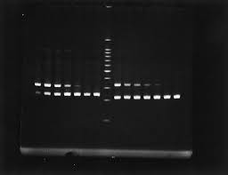 Stromelysin-1 (Matrix Metalloproteinase-3) and Tissue Inhibitor of  Metalloproteinase-3 Are Overexpressed in the Wall of Abdominal Aortic  Aneurysms