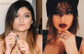 Kylie Jenner Photos Celebs Who Had Plastic Surgery Or Didn T Cheek Fillers Lip Fillers Botox Alternative