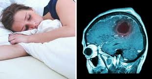 There S A Reason Your Arms Fall Asleep At Night