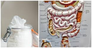 Check spelling or type a new query. Not Found Colonoscopy Colonoscopy Prep Personal Hygiene
