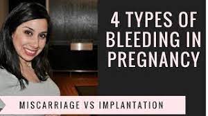 Is spotting or bleeding normal during early pregnancy? Implantation Bleeding When Does It Start How Long Does It Last