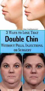 3 Ways To Lose That Double Chin Without Pills Injections Or Surgery In 2020 Chin Exercises Double Chin Exercises Double Chin