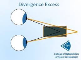 Image result for artistic divergence eyeballs