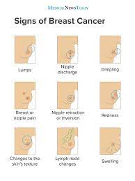 A breast lump or thickening that feels different from the surrounding tissue change in the size, shape or appearance of a breast changes to the skin over the breast, such as dimpling Medical News Today On Twitter A Breast Lump Or Mass Is Just One Of The Possible Symptoms Of Breast Cancer Here Are 8 Potential Signs And Symptoms Anyone Who Notices Any Of