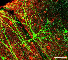 Die nervenzellen sind durch synapsen vielfältig miteinander verknüpft, und deren zahl ist noch etwa 1000mal größer als die der nervenzellen. Nervenzelle Wikipedia
