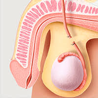 Vasectomia, cunoscuta si sub numele de sterilizare masculina, este procedura medicala prin care canalele deferente care pleaca de la testicule, cele prin care este ejaculat lichidul seminal (sperma). Cirugia De Vasectomia Clinica San Marcos