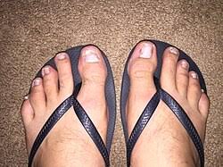 Image result for Pitting nails feet