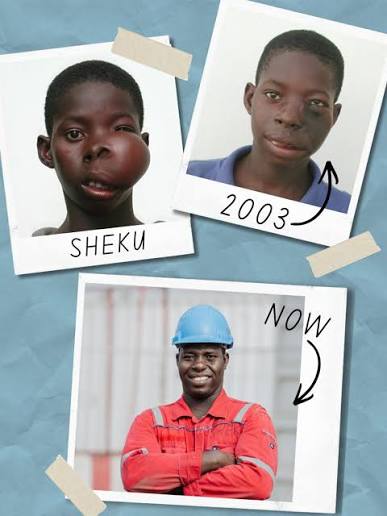 From patient to serving on board 💙⁣ ⁣ “Each time I was doing this, I felt like, 'Yes! Somebody did this for me!'” ⁣ ⁣ In 2003, Sheku received life-changing surgery through