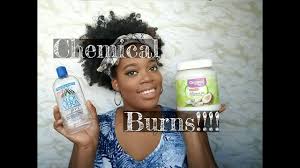 Hair dye can strip the of natural pigment, thus replacing the color with a synthetic colorant. How To Heal Chemical Relaxer Burn Youtube