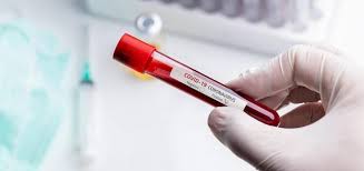 Organizează în data de 10.06.2011 ora 10 la sediul unităţii, în conformitate cu prevederile. Inturda Ro Dsp