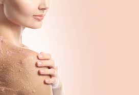 Buat sendiri scrub kopi yang tidak meninggalkan rasa berminyak di kulit sehabis dipakai. Scrubbing Badan Berapa Kali Seminggu Agar Kulit Sehat