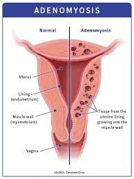 Image result for uterus