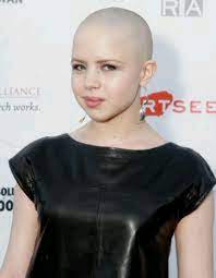 Too Much Super Short Hair Bald Women Bald Girl