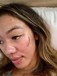 Ski pants falling off