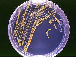 Abr 28, 2021 bacteriología, bacteriólogo, día del bacteriólogo, jorge lleras parra, un día como hoy. Bacteriologo Definicion Y Sinonimos De Bacteriologo En El Diccionario Espanol