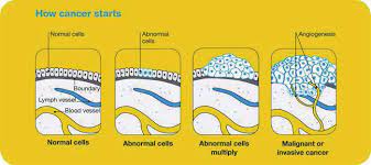 Ans cell which function normally for tissues that are in characteristics of cancer cells. 2 How Cancer Starts The Special Characteristics Of Cancer Cells Download Scientific Diagram