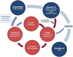 Image result for Recurrent Cystitis