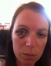 Such a powerful woman! Combining professional and lived experience isn't…