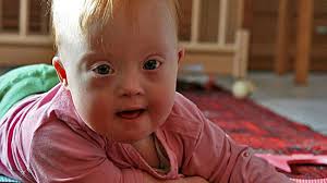 Kids with down syndrome., boca raton, florida. Vanessa Ein Ganz Besonderes Kind Bad Camberg