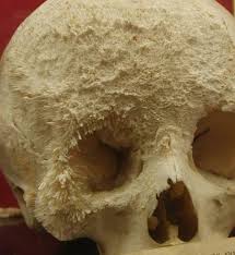 I keep hoping it is a muscle pain. Thinking Minds This Is What Bone Cancer Looks Like Facebook