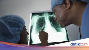 Namun ada baiknya untuk mencegah bukan? Paru Paru Terisi Cairan Bisakah Disembuhkan