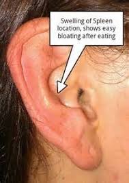 Swelling Of Spleen Ear Yahoo Image Search Results Acupuncture Reflexology Bloating After Eating