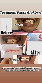 Pasta Gigi Drw Skincare Gigi Putih Klinik Cantik Drw Skincare By Dr Wahyu Triasmara Facebook