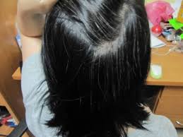 This is because nutritional deficiencies, such as vitamins b12 and d3 and calcium, are one of the leading causes of gray/white hair in children (2). Causes Of Premature Greying Hair Remedies