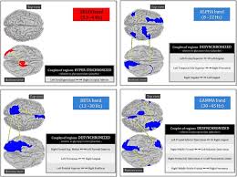 Image result for Scopolamine