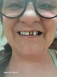 Good morning y'all, I had to share this funny photo, this was me 2 months  ago. Harmony said Nanny you've got 2 gold teeth ! 🤣🤣🤣🤣 (This also shows  the botched dental