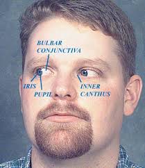 Essentials of Oral Medicine