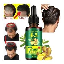 Even hair oil virgins can get a formula that's right for them on the first try, because prose customizes each bottle of hair oil specifically for the purchaser. Hair Boost 7 Days Hair Growth Activator Hair Loss Oil Best Price Online Jumia Kenya