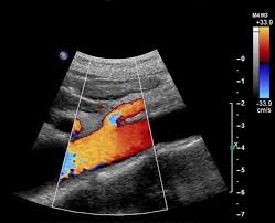 Ct Scan Charges In Ahmedabad Ct Scan Machine