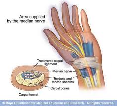 Pinched Median Nerve Mayo Clinic Fisioterapia Esportiva Fisioterapia