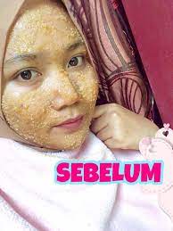 Tunggu hingga sejuk dan daun layu. Hanya Guna 3 Bahan Skrub Diy Gadis Ini Hilangkan Parut Jerawat Jeragat Dan Sel Kulit Mati Yoy Network