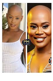 Ant #bedjine Ak #rutshelleguillaume Kiyès Tèt Kale Tap Fè Pi Byen Si Yo Te  Kale Tèt Yo🤣