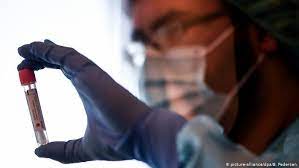 In laboratoarele de stat, pretul unui test variaza intre 250 si 280 de lei. Germania Teste Gratuite Pentru Covid 19 Germania Dw 01 08 2020