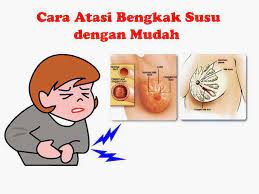Amandel bengkak atau radang amandel dapat mengganggu kondisi fisik seseorang. Bmom Hq Pakar Penyusuan 6 Cara Mengatasi Bengkak Susu Bahaya Kalau Dibiarkan Tanda Bengkak Susu Antara Tanda Bengkak Susu Adalah Rasa Sakit Dan Tegang