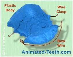 Jul 06, 2021 · the cost of replacement retainers will depend on the type of retainer you get and whether. How Much Do Retainers Cost New Replacement Prices Diy Kits