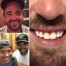 Riverbend Dentistry, 600 Monroe St, Ste 300, Jefferson City, MO 65101, US