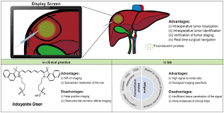 Image result for Primary Tumor Localization